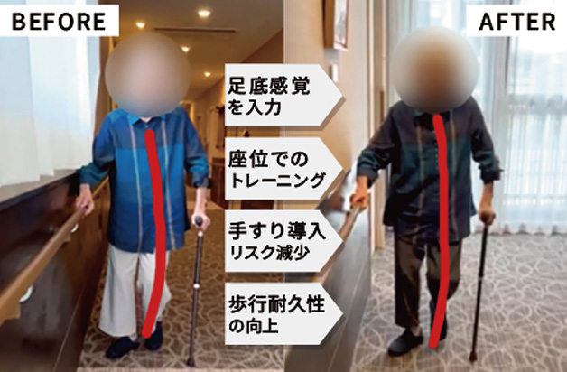 リハビリビフォアアフター写真01