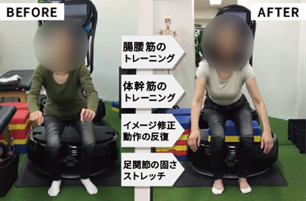 リハビリビフォアアフター写真02