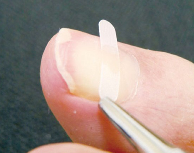 フットケア写真